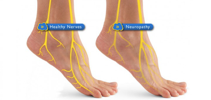 5 Signs Your Neuropathy May Have a Reversible Cause